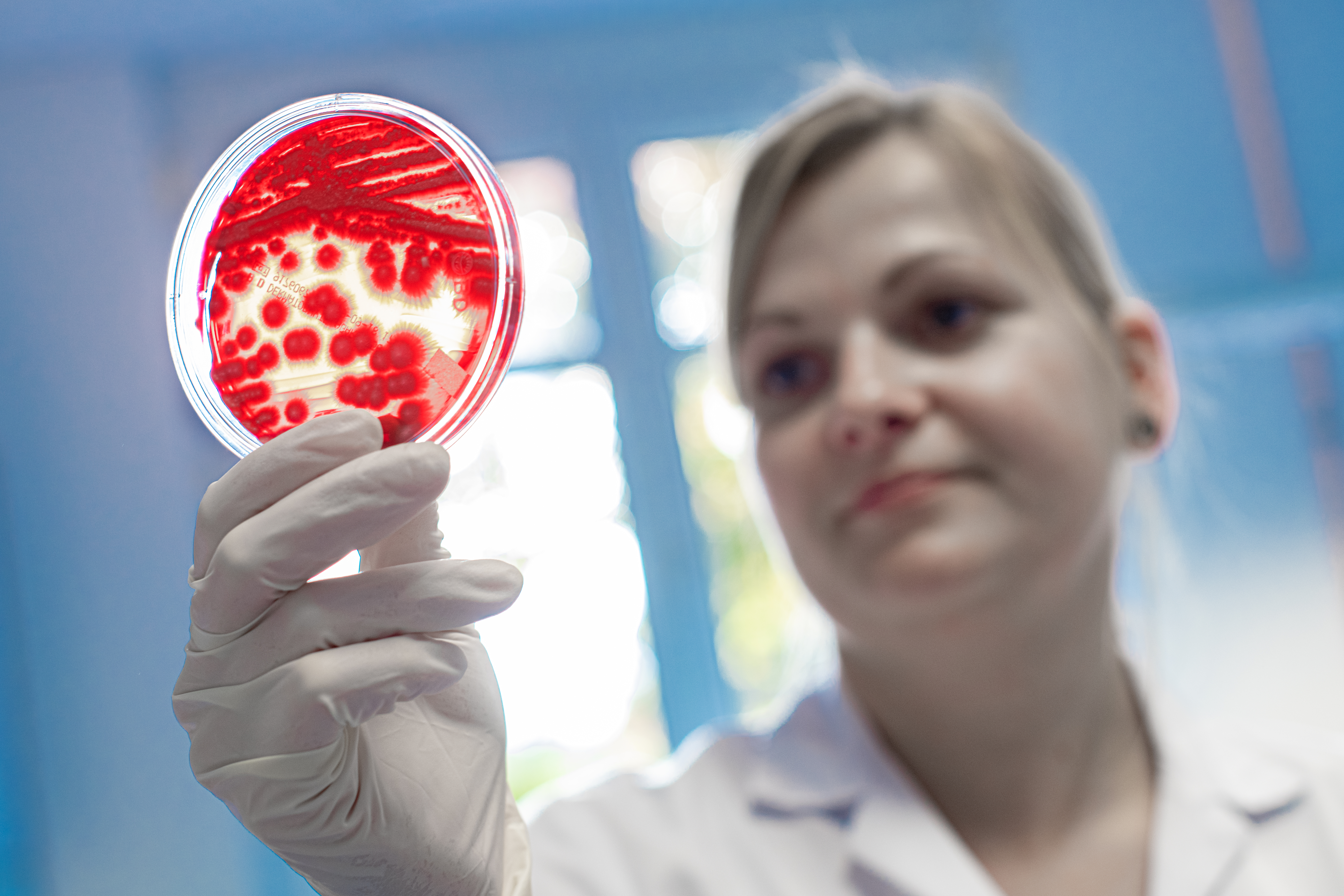 Mikrobiologische Nachweismöglichkeiten von Erregern